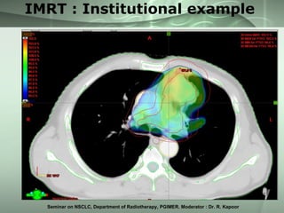 Non Small Cell Lung Cancer | PPT