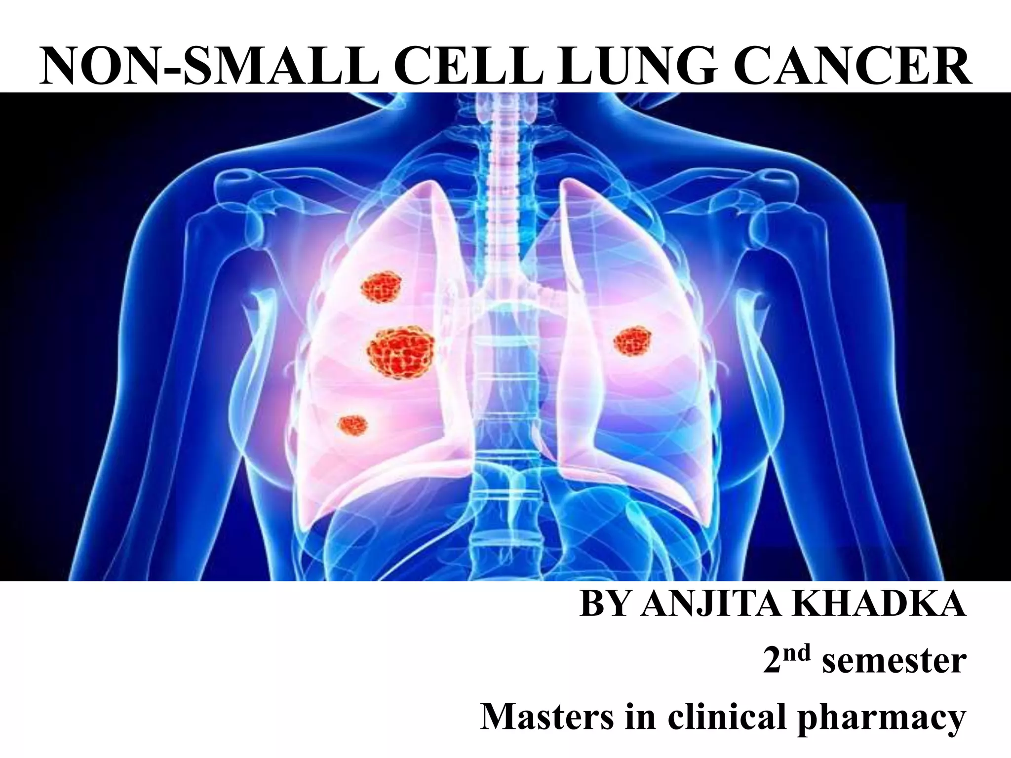 Non small cell lung cancer | PPTX