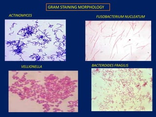 Processing of samples
Gross examination
• Blood
• Purulence
• Necrotic tissue
• Foul odor
• Sulphur granules
 