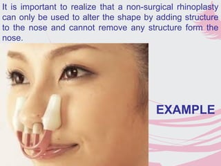 It is important to realize that a non-surgical rhinoplasty
can only be used to alter the shape by adding structure
to the nose and cannot remove any structure form the
nose.
EXAMPLE
 