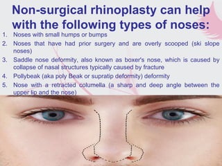 Non-surgical rhinoplasty can help
with the following types of noses:
1. Noses with small humps or bumps
2. Noses that have had prior surgery and are overly scooped (ski slope
noses)
3. Saddle nose deformity, also known as boxer's nose, which is caused by
collapse of nasal structures typically caused by fracture
4. Pollybeak (aka poly Beak or supratip deformity) deformity
5. Nose with a retracted columella (a sharp and deep angle between the
upper lip and the nose)
6. Noses with slight asymmetry
 