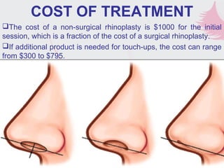 COST OF TREATMENT
The cost of a non-surgical rhinoplasty is $1000 for the initial
session, which is a fraction of the cost of a surgical rhinoplasty.
If additional product is needed for touch-ups, the cost can range
from $300 to $795.
 
