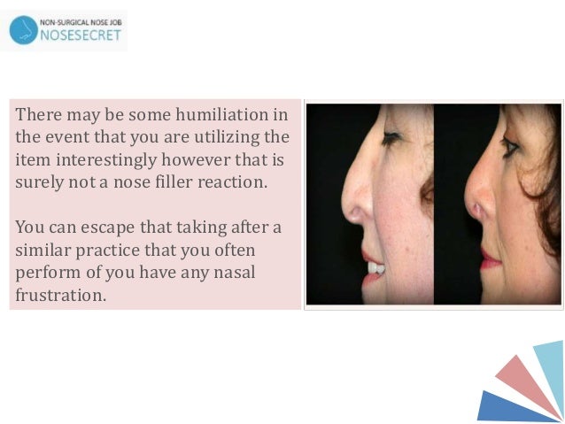 Non Surgical Nose Job For Wide Nose Near Me Non Surgical
