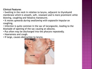 Clinical Features
• Swelling in the neck in relation to larynx, adjacent to thyrohyoid
membrane which is smooth, soft, resonant and is more prominent while
blowing, coughing and Valsalva manoeuvre.
• It moves upwards during swallowing with expansile impulse on
coughing.
• Infection is quite common in the sac of laryngocele, leading to the
blockade of opening of the sac causing an abscess.
• Pus often may be discharged into the pharynx repeatedly.
• Hoarseness and cough.
• If large, causes obstruction to larynx.
 