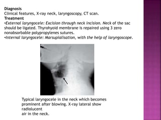 Diagnosis
Clinical features, X-ray neck, laryngoscopy, CT scan.
Treatment
•External laryngocele: Excision through neck incision. Neck of the sac
should be ligated. Thyrohyoid membrane is repaired using 3 zero
nonabsorbable polypropylenes sutures.
•Internal laryngocele: Marsupialisation, with the help of laryngoscope.
Typical laryngocele in the neck which becomes
prominent after blowing. X-ray lateral show
radiolucent
air in the neck.
 