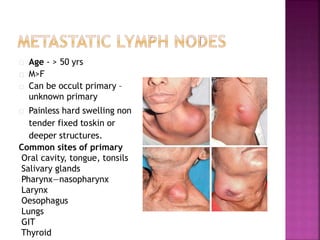 Age - > 50 yrs
M>F
Can be occult primary –
unknown primary
Painless hard swelling non
tender fixed toskin or
deeper structures.
Common sites of primary
Oral cavity, tongue, tonsils
Salivary glands
Pharynx—nasopharynx
Larynx
Oesophagus
Lungs
GIT
Thyroid
 