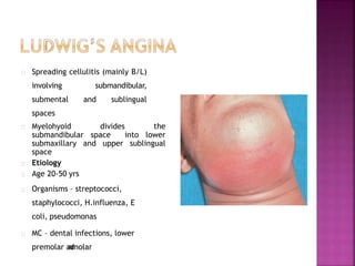 Spreading cellulitis (mainly B/L)
involving submandibular,
submental and sublingual
spaces
Myelohyoid divides the
submandibular space into lower
submaxillary and upper sublingual
space
Etiology
Age 20-50 yrs
Organisms – streptococci,
staphylococci, H.influenza, E
coli, pseudomonas
MC – dental infections, lower
premolar andmolar
 