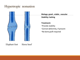 Biology: good , viable , vascular
Stability: lacking
Treatment:
•Provide stability
•Correct deformity, if present
•No bone graft required
Elephant foot Horse hoof
 