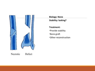 Biology: None
Stability: lacking?
Treatment:
•Provide stability
•Bone graft
•Other reconstruction
Necrotic Defect
 