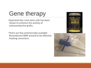 Gene therapy
•Aspirated iliac crest stem cells has been
shown to enhance the activity of
osteoconductive grafts.
•There are few commercially available
Recombinant BMP proved to be effective
treating nonunions.
 