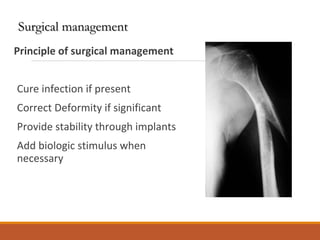 Principle of surgical management
Cure infection if present
Correct Deformity if significant
Provide stability through implants
Add biologic stimulus when
necessary
Surgical managementSurgical management
 