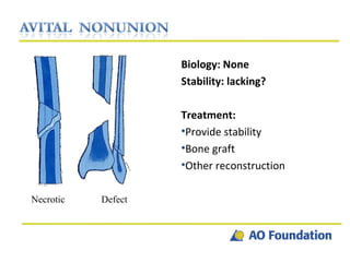 Biology: None Stability: lacking?  Treatment: Provide stability Bone graft Other reconstruction Necrotic Defect 