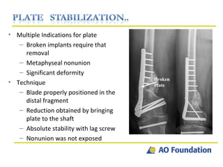 Multiple Indications for plate Broken implants require that removal Metaphyseal nonunion Significant deformity Technique Blade properly positioned in the distal fragment Reduction obtained by bringing plate to the shaft Absolute stability with lag screw Nonunion was not exposed Broken Plate 