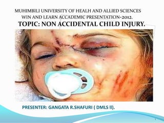 MUHIMBILI UNIVERSITY OF HEALH AND ALLIED SCIENCES
WIN AND LEARN ACCADEMIC PRESENTATION-2012.

TOPIC: NON ACCIDENTAL CHILD INJURY.

PRESENTER: GANGATA R.SHAFURI ( DMLS ll).
1

 