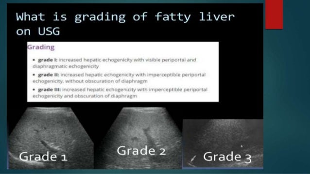 How to reduce stomach fat naturally photo 3