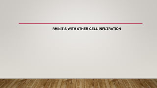 RHINITIS WITH OTHER CELL INFILTRATION
 