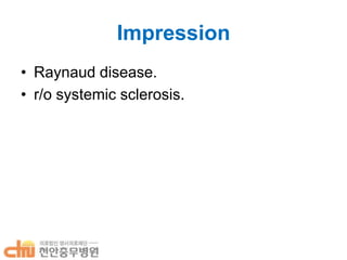 Impression
• Raynaud disease.
• r/o systemic sclerosis.

 