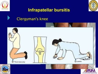 Non Arthritic Knee Pain PPT non-arthritic-knee-pain-ppt