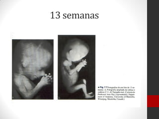 13 semanas
 