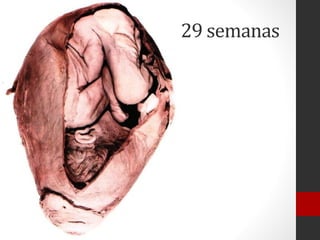 29 semanas
 