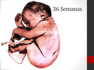 36 Semanas
 