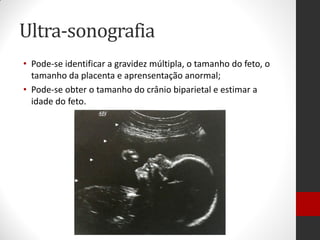 Ultra-sonografia
• Pode-se identificar a gravidez múltipla, o tamanho do feto, o
tamanho da placenta e aprensentação anormal;
• Pode-se obter o tamanho do crânio biparietal e estimar a
idade do feto.
 