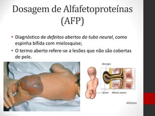 Dosagem de Alfafetoproteínas
(AFP)
• Diagnóstico de defeitos abertos do tubo neural, como
espinha bífida com mielosquise;
• O termo aberto refere-se a lesões que não são cobertas
de pele.
 