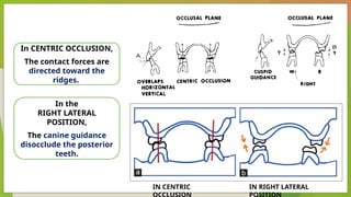 Tooth Disocclude Non Balanced Occlusion in prosthodontics | PPTX