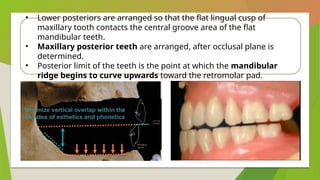 Posterior Ridge Non Balanced Occlusion in prosthodontics | PPTX