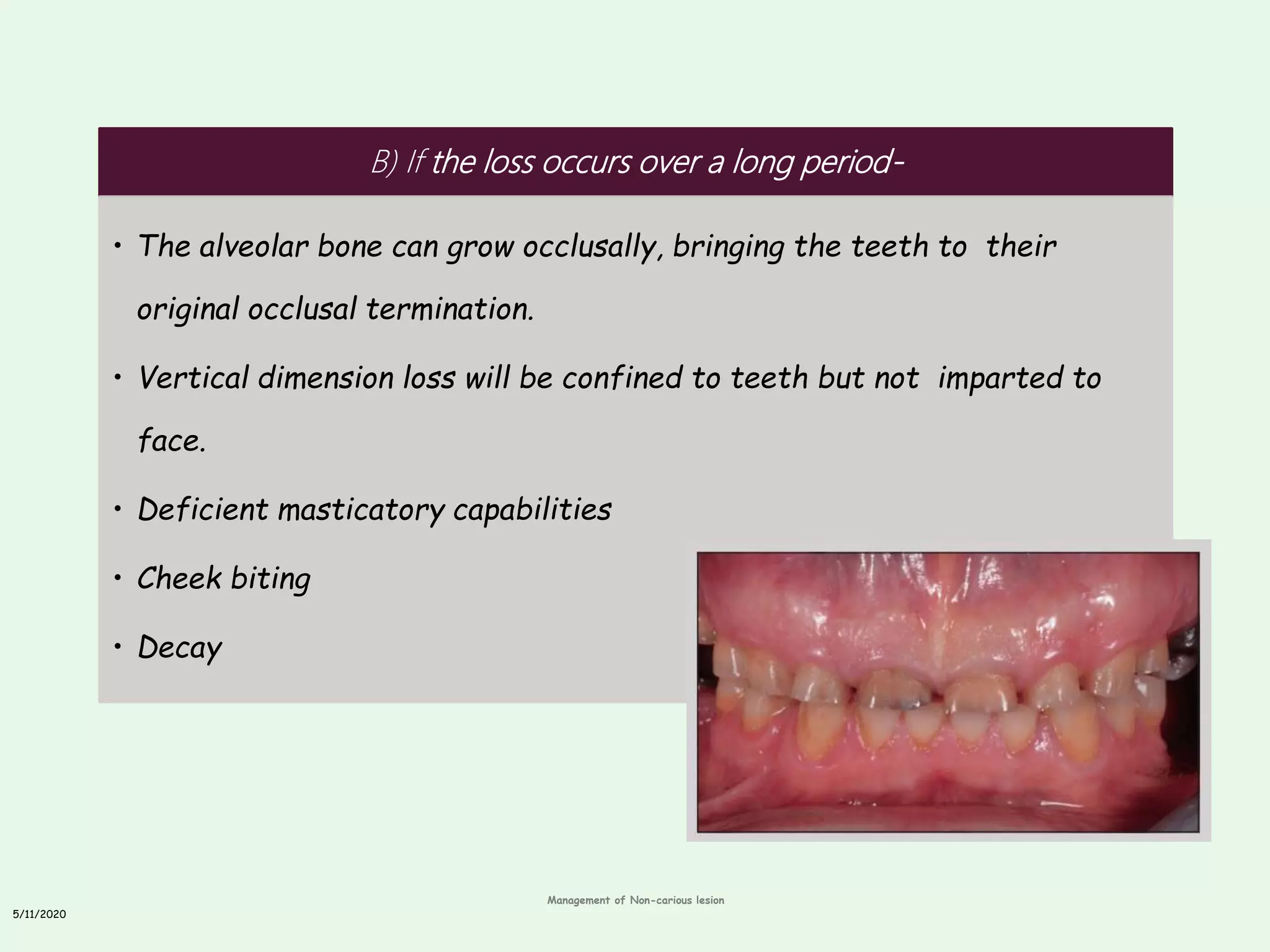 Non carious tooth lesions | PPTX