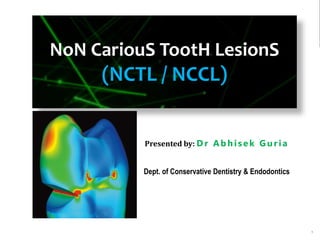 1
NoN CariouS TootH LesionS
(NCTL / NCCL)
Presented by: D r Ab h isek Gur ia
Dept. of Conservative Dentistry & Endodontics
 