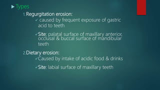  Types
1. Regurgitation erosion:
 caused by frequent exposure of gastric
acid to teeth
Site: palatal surface of maxillary anterior,
occlusal & buccal surface of mandibular
teeth
2.Dietary erosion:
Caused by intake of acidic food & drinks
Site: labial surface of maxillary teeth
 