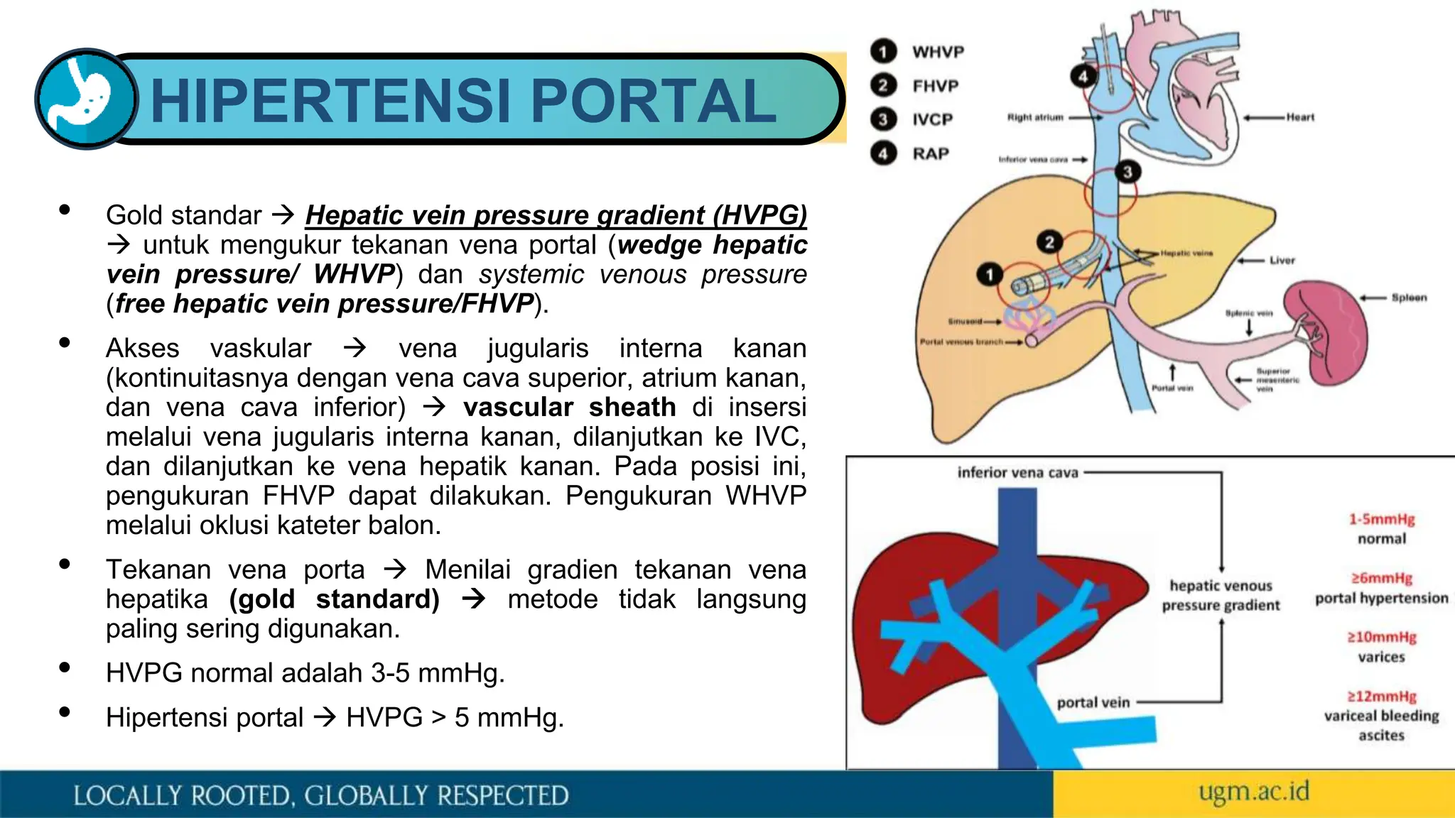 HIPERTENSI PORTAL
• Gold standar  Hepatic vein pressure gradient (HVPG)
 untuk mengukur tekanan vena portal (wedge hepatic
vein pressure/ WHVP) dan systemic venous pressure
(free hepatic vein pressure/FHVP).
• Akses vaskular  vena jugularis interna kanan
(kontinuitasnya dengan vena cava superior, atrium kanan,
dan vena cava inferior)  vascular sheath di insersi
melalui vena jugularis interna kanan, dilanjutkan ke IVC,
dan dilanjutkan ke vena hepatik kanan. Pada posisi ini,
pengukuran FHVP dapat dilakukan. Pengukuran WHVP
melalui oklusi kateter balon.
• Tekanan vena porta  Menilai gradien tekanan vena
hepatika (gold standard)  metode tidak langsung
paling sering digunakan.
• HVPG normal adalah 3-5 mmHg.
• Hipertensi portal  HVPG > 5 mmHg.
 