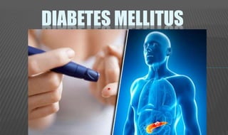 DIABETES MELLITUS
 
