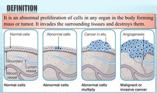 DEFINITION
It is an abnormal proliferation of cells in any organ in the body forming
mass or tumor. It invades the surrounding tissues and destroys them.
 