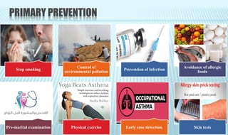 PRIMARY PREVENTION
Stop smoking
Control of
environmental pollution
Prevention of infection
Avoidance of allergic
foods
Pre-marital examination Physical exercise Early case detection. Skin tests
 