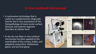 In vivo confocal microscopy
• A noninvasive technology that is
useful as a supplementary diagnostic
tool for the in vivo assessment of the
histopathology of many ocular surface
diseases and anterior-segment
disorders at cellular level.
• In the dry eye field, in vivo confocal
microscopy has been applied to the
examination of the cornea, bulbar and
palpebral conjunctiva, Meibomian
gland, and lacrimal gland.
 