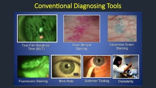 Conventional Diagnosing Tools
 