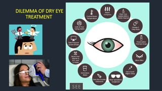 DILEMMA OF DRY EYE
TREATMENT
 