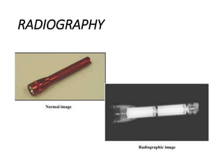 RADIOGRAPHY
 