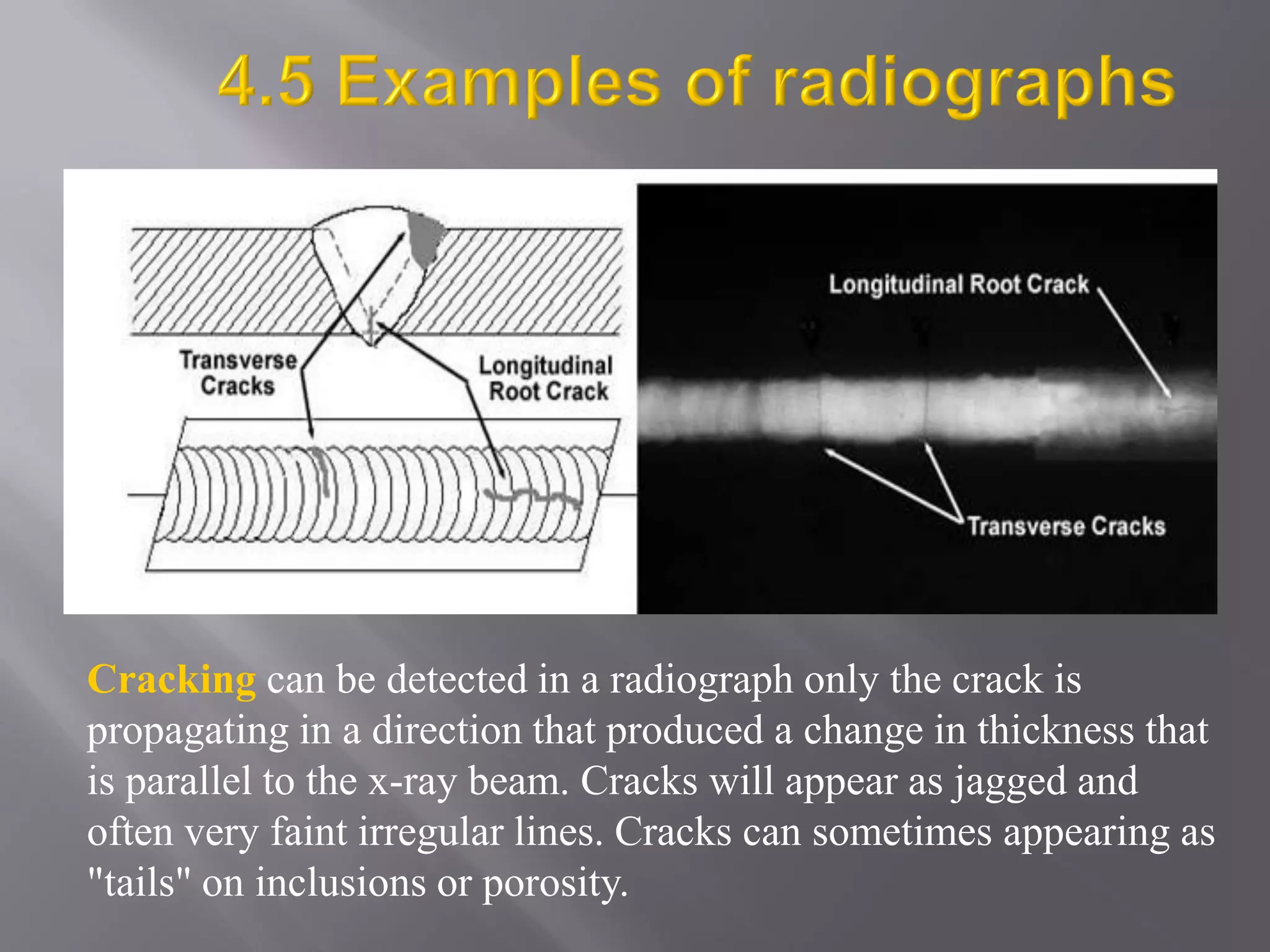 Cracking can be detected in a radiograph only the crack is
propagating in a direction that produced a change in thickness that
is parallel to the x-ray beam. Cracks will appear as jagged and
often very faint irregular lines. Cracks can sometimes appearing as
"tails" on inclusions or porosity.
 