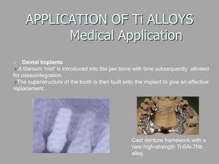 APPLICATION OF Ti ALLOYS
Medical Application
 Dental Implants
A titanium 'root' is introduced into the jaw bone with time subsequently allowed
for osseointegration.
The superstructure of the tooth is then built onto the implant to give an effective
replacement.
Cast denture framework with a
new high-strength Ti-6Al-7Nb
alloy.
 
