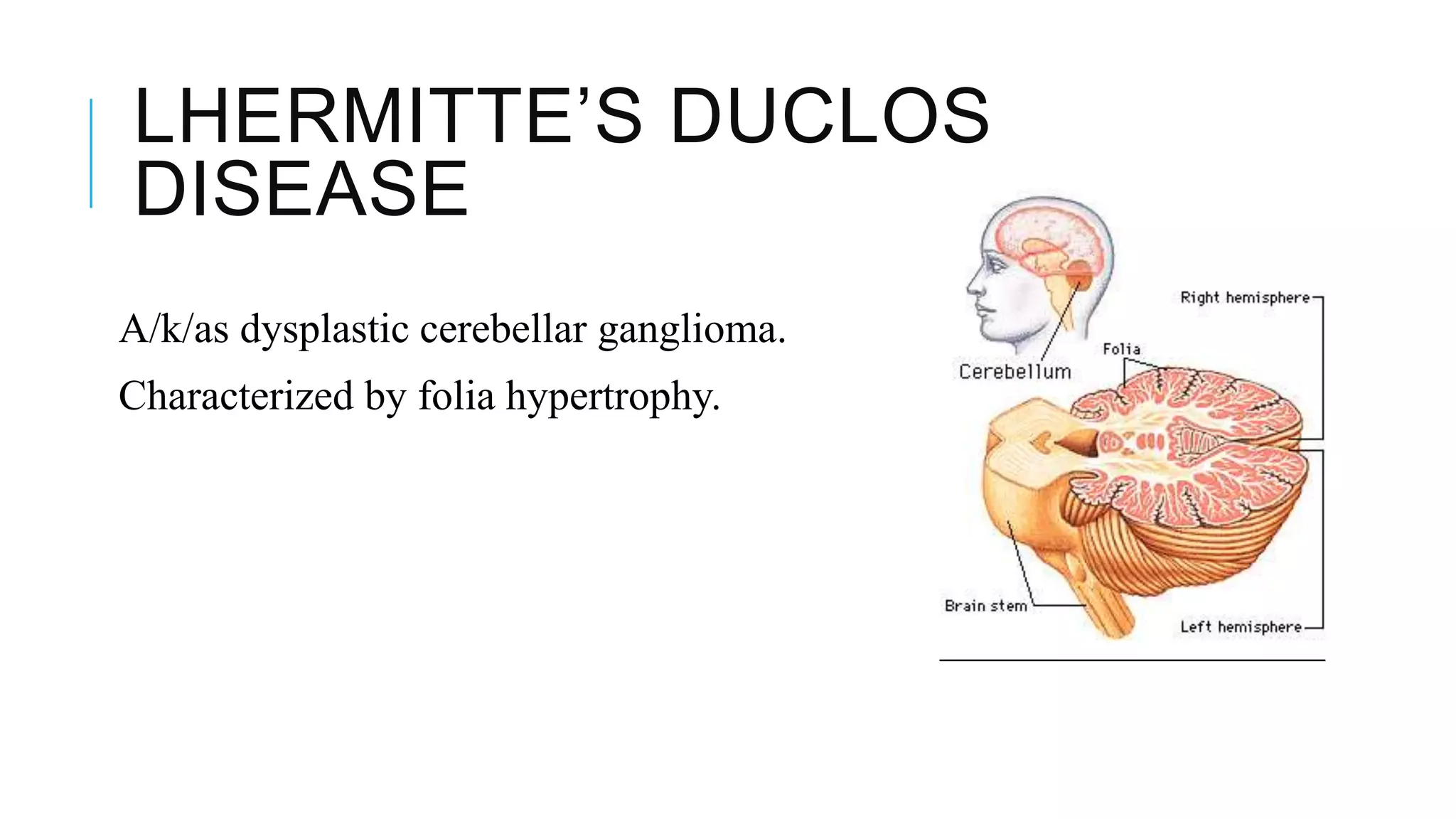NON GLIAL TUMORS | PPTX