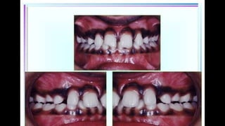 NON GROWING.pptx