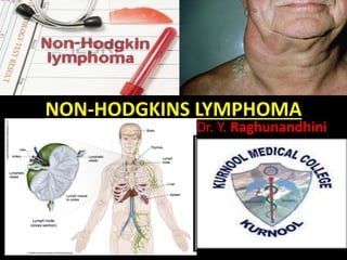 NON-HODGKINS LYMPHOMA
Dr. Y. Raghunandhini
 