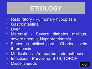 ETIOLOGY
• Respiratory - Pulmonary hypoplasia
• Gastrointestinal
• Liver
• Maternal - Severe diabetes mellitus,
severe anemia, Hypoproteinemia
• Placenta-umbilical cord - Chorionic vein
thrombosis
• Medications - Antepartum indomethacin
• Infectious - Parvovirus B 19, TORCH
• Miscellaneous KAY
 
