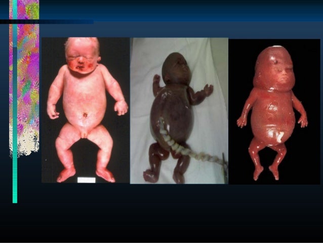photo of 9 week old fetus