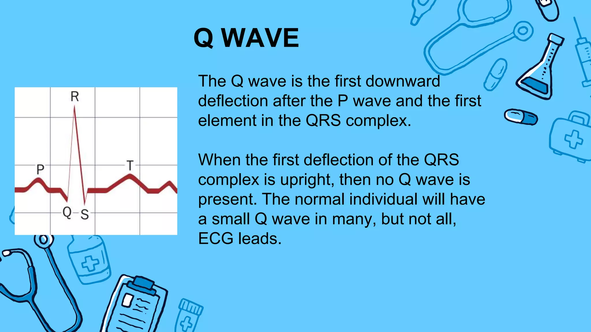 non-infarction-q-waves-ppt