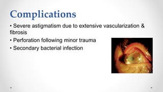 Complications
• Severe astigmatism due to extensive vascularization &
fibrosis
• Perforation following minor trauma
• Secondary bacterial infection
 