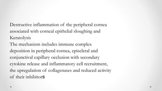 Destructive inflammation of the peripheral cornea
associated with corneal epithelial sloughing and
Keratolysis
The mechanism includes immune complex
deposition in peripheral cornea, episcleral and
conjunctival capillary occlusion with secondary
cytokine release and inflammatory cell recruitment,
the upregulation of collagenases and reduced activity
of their inhibitors
 